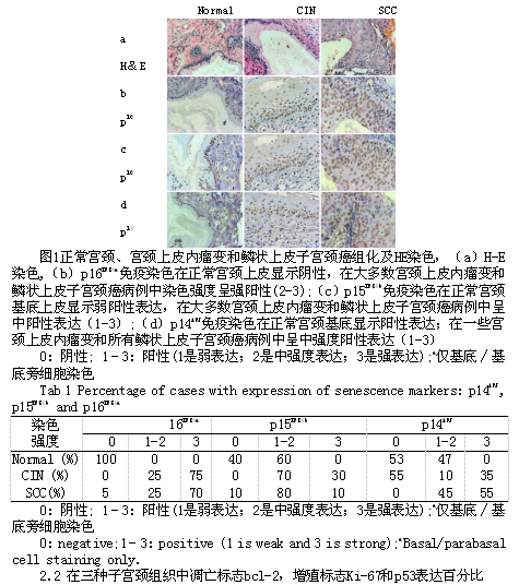 衰老和凋亡相关蛋白在宫颈鳞状细胞癌中的表达及临床意义