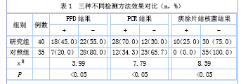 打印预览