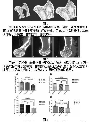 第6周时a组兔股骨头软骨下骨小梁明显变薄,稀疏,紊乱甚至出现断裂