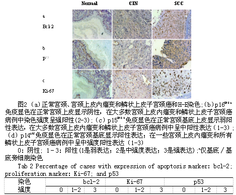 衰老和凋亡相关蛋白在宫颈鳞状细胞癌中的表达及临床意义