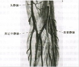 分别为肘正中静脉,贵要静脉和头静脉