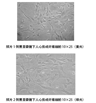 普通光学显微镜观察 差速贴壁法最先贴壁的为心肌成纤维细胞