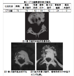 脊柱结核是全身骨结核发病率最高的疾病,研究发现,脊柱结核