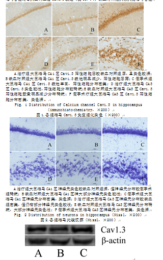 丁苯酞对慢性脑缺血大鼠海马中钙通道cav1.3表达的影响