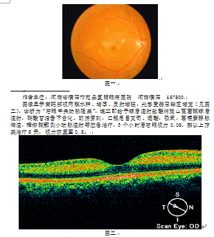 斑秃局部封闭致右眼中央动脉阻塞一例