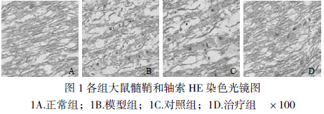 opc 移植对eae 大鼠运动功能及脊髓有髓神经纤维形态的影响