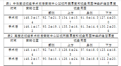 临床中均采用飞秒激光对近视进行治疗,因为角膜瓣具有较为正确的制作