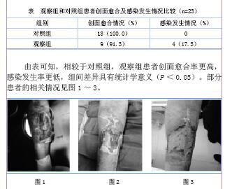 造成患者长期卧床,换药,反复搬动患肢,刺激损伤周围软组织,加重肿胀和