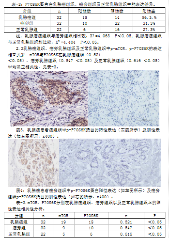 结肠癌中p—mtor,p—p70s6k的表达与临床病理意义