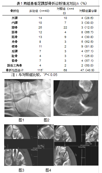 多层螺旋ct与数字化摄影诊断足踝部骨折及关节脱位临床比较