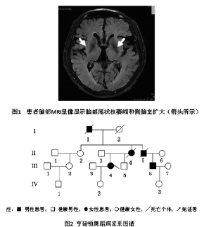 1例亨廷顿舞蹈病的诊断经验附家系报告