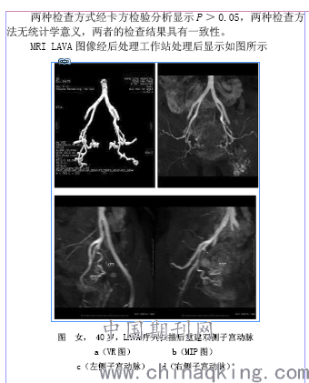 超选择插管入子宫动脉,经dsa造影证实肿瘤供血血管后,再行经子宫动脉