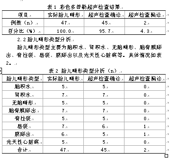 每年出生人口数_杭州每年人口增长